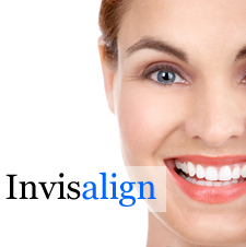 Invisalign Clear Aligners