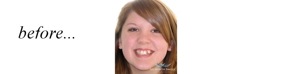 Before Dental Treatment