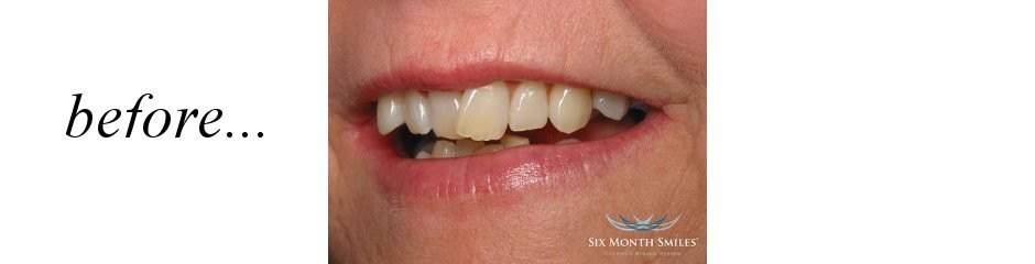 Before Dental Treatment